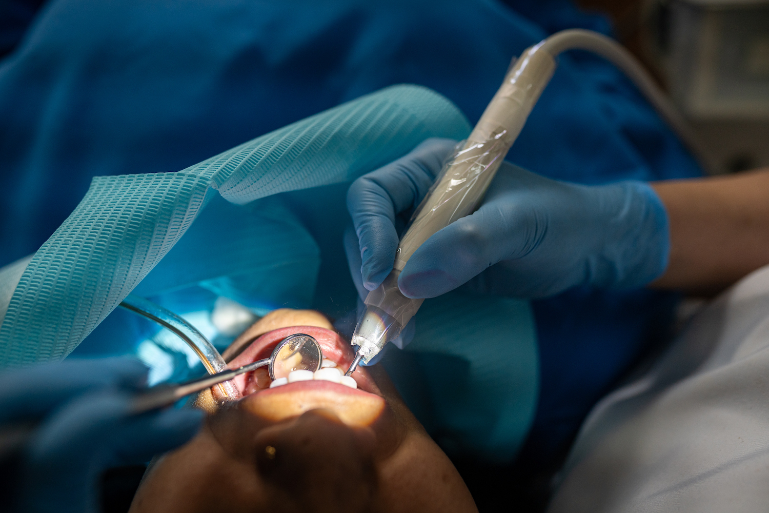 Ankara Gaziosmanpaşa'da diş hekimi tarafından uygulanan kanal tedavisi sonrası iyileşme süreci, ağrı yönetimi ve ağız bakımı hakkında bilgilendirici sağlık rehberi görseli.