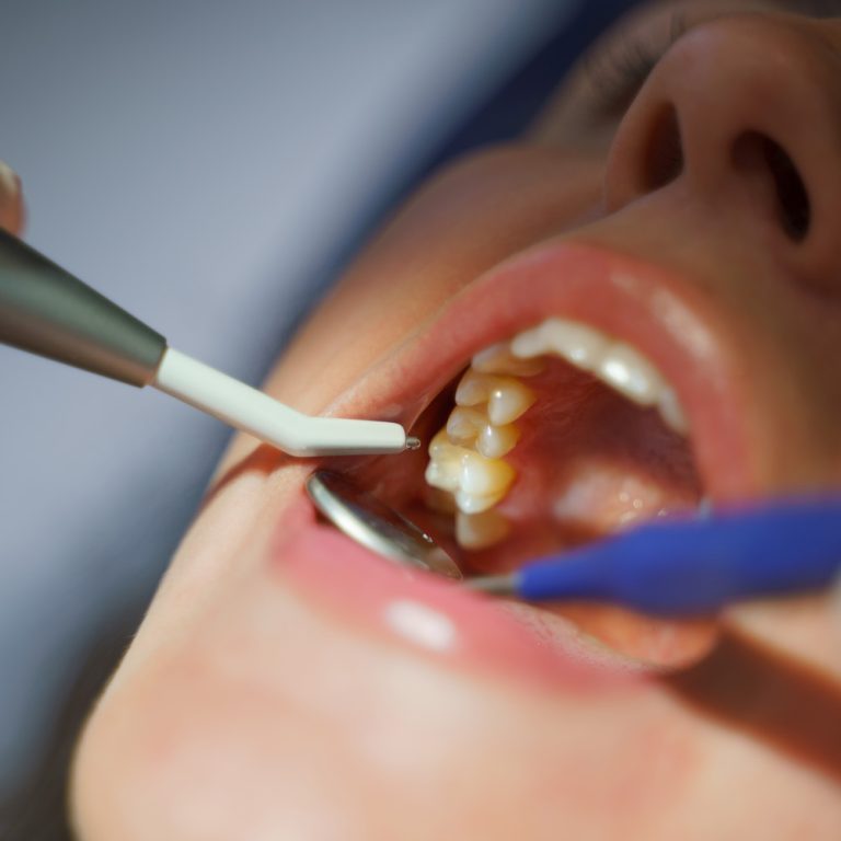 Close-up of dental examination in an ambulance.