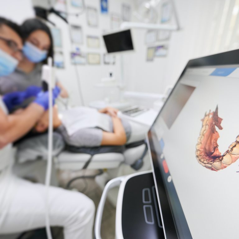 Dentist scanning patient's teeth with modern scanning machine. Digital print of patient's teeth is on big screen. Modern high precision technologies. Concept of modern dentistry
