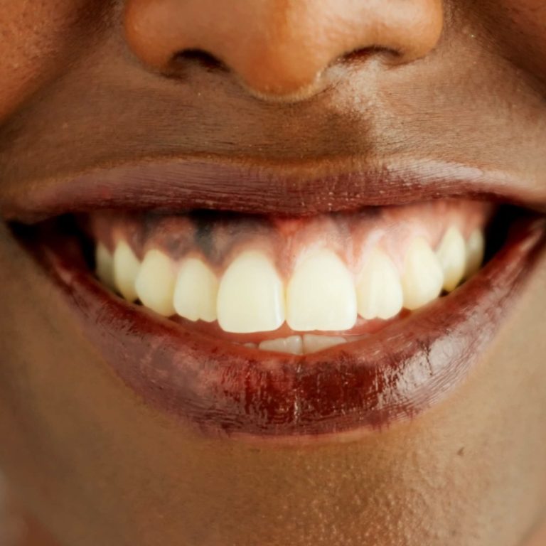 Person, african and closeup with teeth, smile and dental care and oral hygiene or health. Mouth, zo.