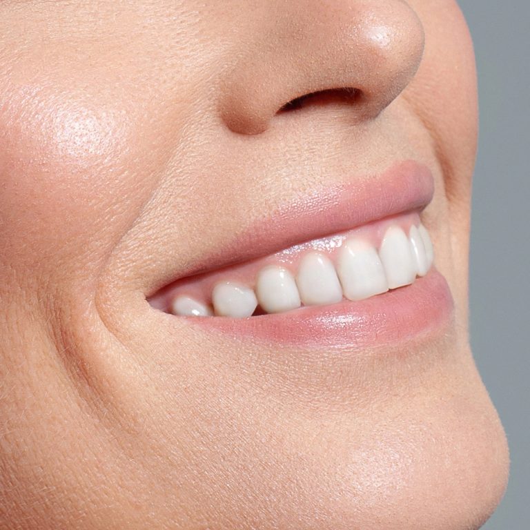 Smiling white woman with perfect skin close-up. Dental care, dentistry, skin care