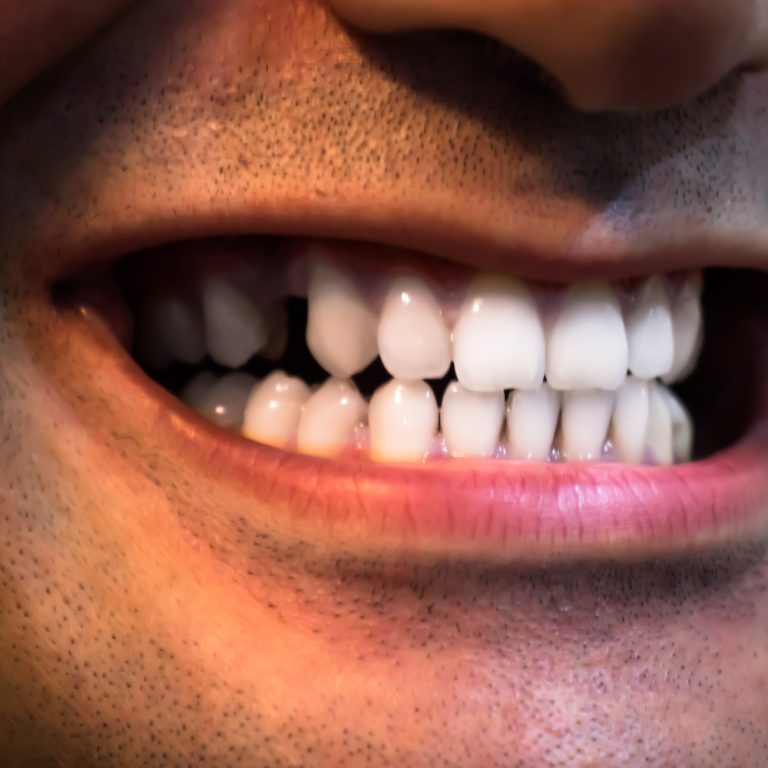 A closeup shot of a male open mouth showing white teeth