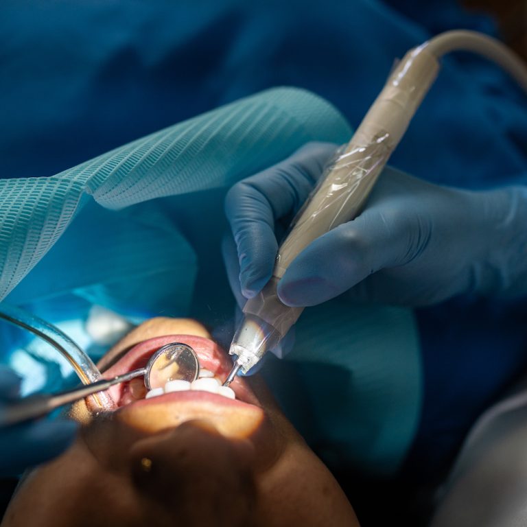 Ankara Gaziosmanpaşa'da diş hekimi tarafından uygulanan kanal tedavisi sonrası iyileşme süreci, ağrı yönetimi ve ağız bakımı hakkında bilgilendirici sağlık rehberi görseli.