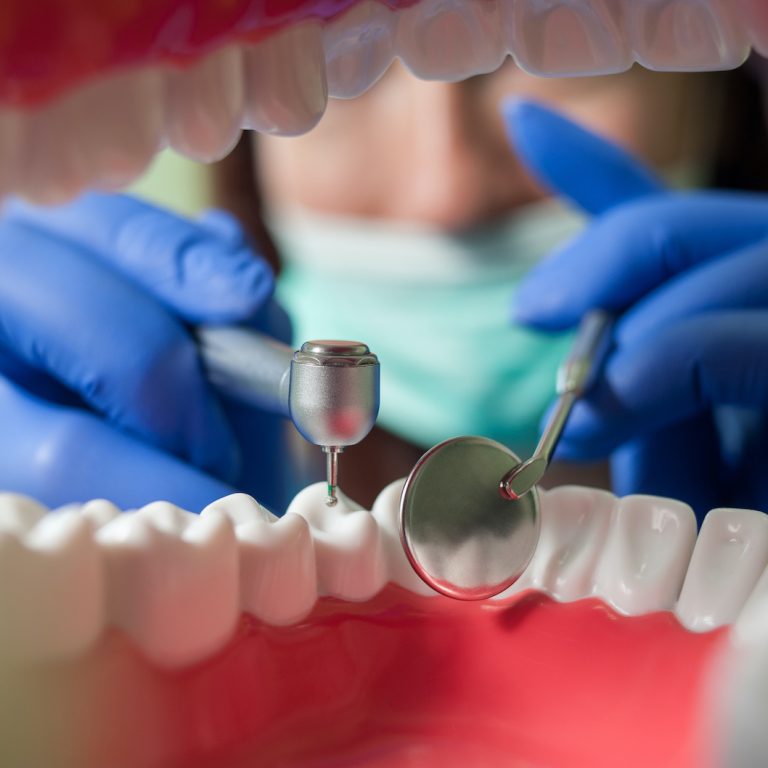 Dentist drilling teeth. View of a doctor from the inside of mouth. Close-up. Therapy