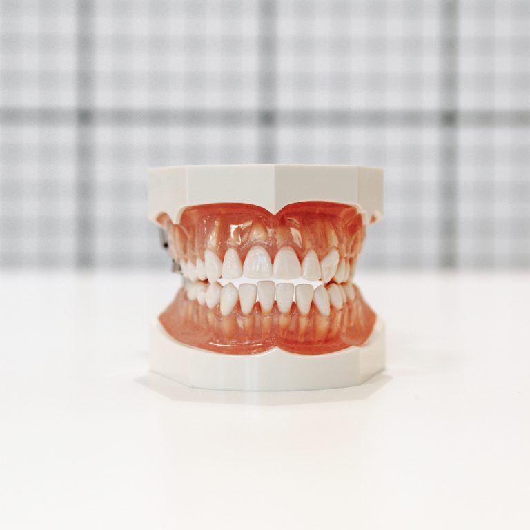 A closeup of human artificial jaws on a white table