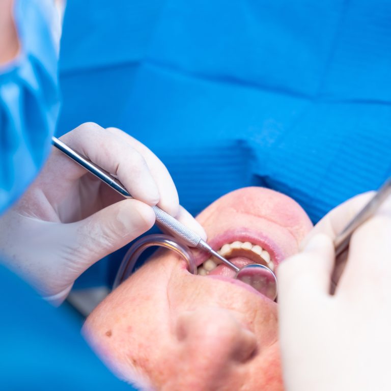 Dental clinic, detail of a doctor's hands checking the teeth of an elderly woman