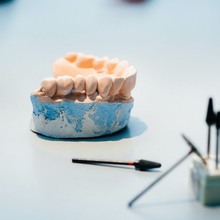 Model of teeth made of plaster of the jaw for dental technicians.