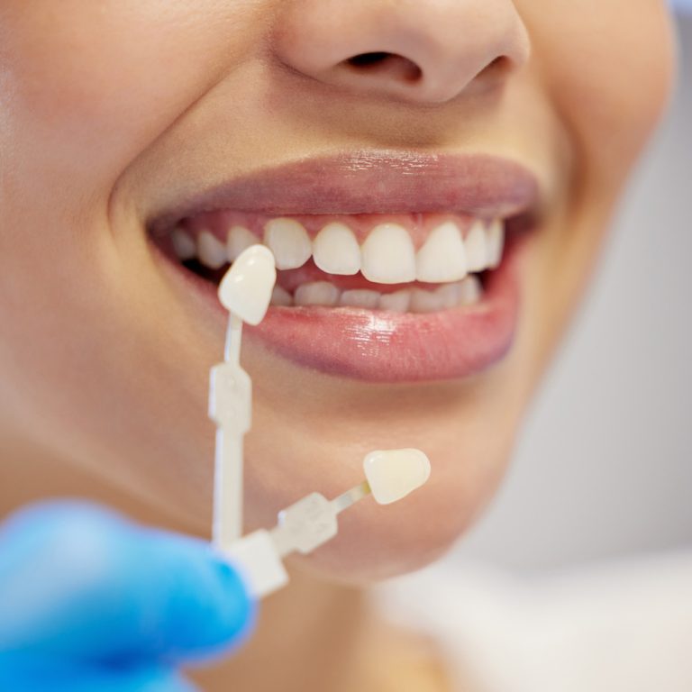 Shot of an unrecognisable woman having her teeth capped at the dentist.