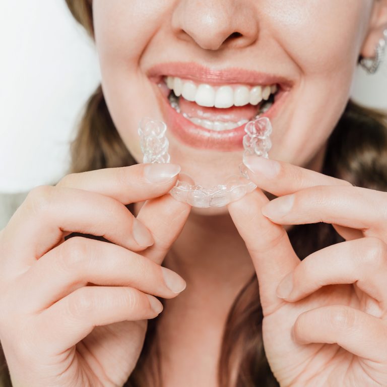 Woman smiling and holding a clear teeth aligner with both hands, dental care and orthodontic treatment aligners