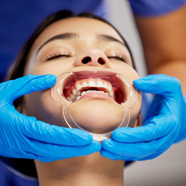 Using a cheek retractor can make a real difference.